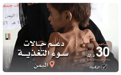 دعم حالات سوء التغذية باليمن - جمعية تنمية الخيرية