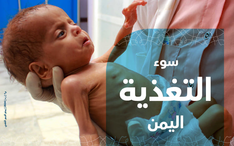 سوء التغذية اليمن - نماء الخيرية